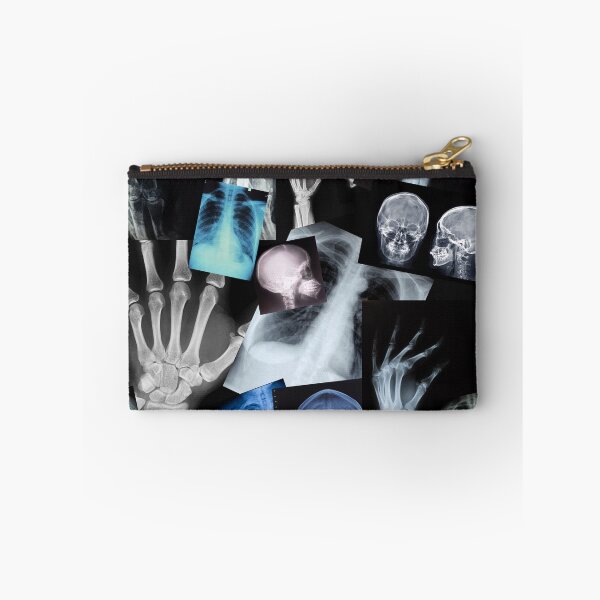 Item preview, X Ray Pattern - Human Anatomy designed and sold by alinabeska.