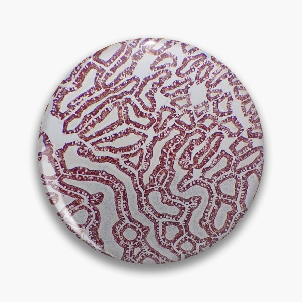 Item preview, Small bowel histology, 40x, cytokeratin immunohistochemistry designed and sold by Psymier.