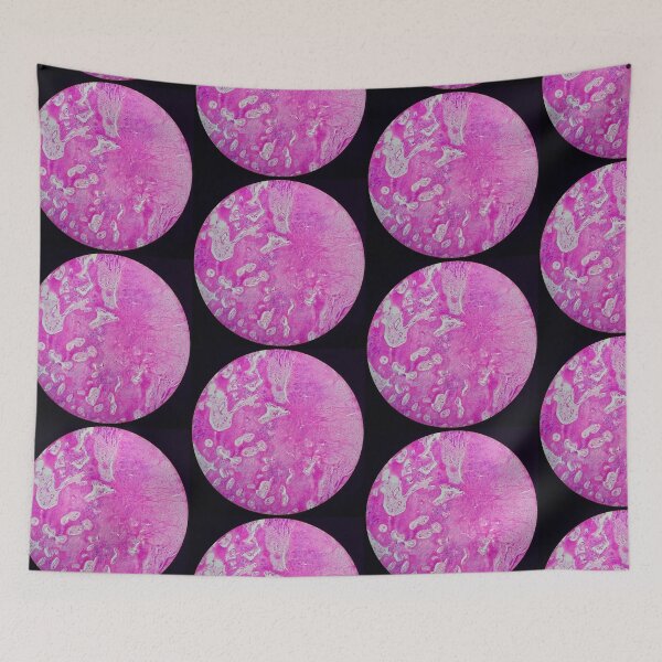 Item preview, Nora lesion, bone histology, H&E, 40x  designed and sold by Psymier.