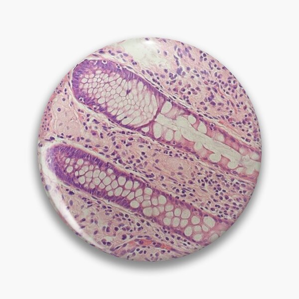 Item preview, Crypt Glands - Histology of The Gastrointestinal Tract  designed and sold by CellPathWorld.