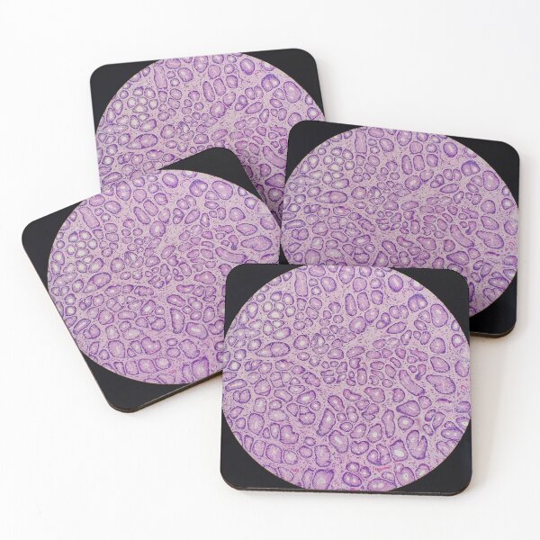 Item preview, Stomach histology, 100x, H&E, gastric pits. designed and sold by Psymier.