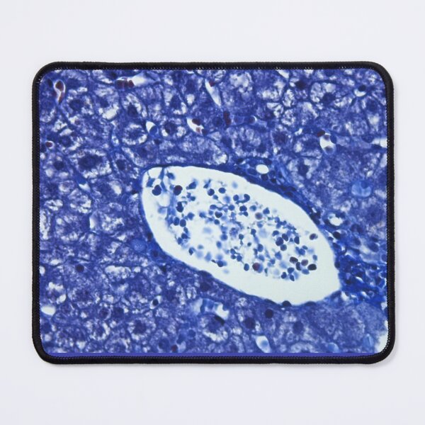 Item preview, Masson's trichrome stain in liver (collagen) designed and sold by CellPathWorld.
