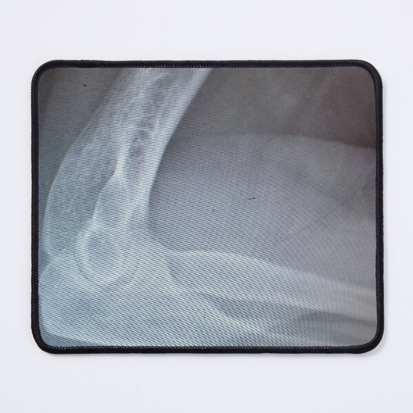 Item preview, X-Rayed Elbow designed and sold by Scott and Mary Schneider art_photography.