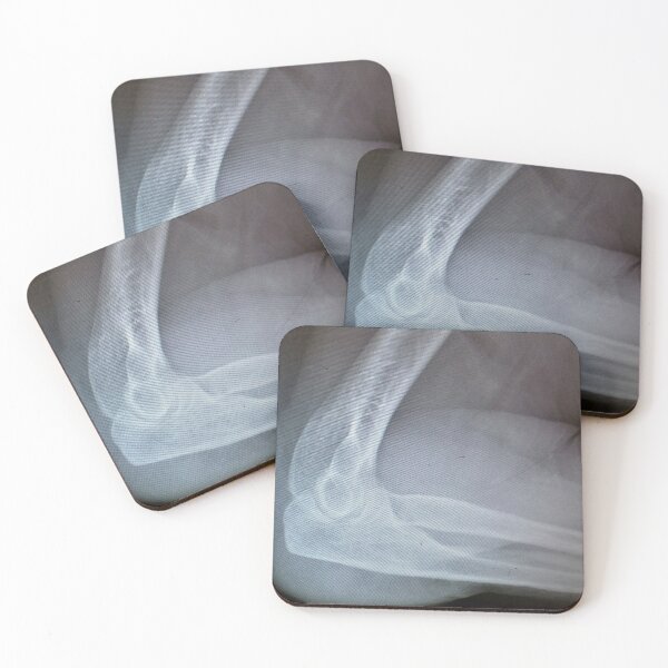 Item preview, X-Rayed Elbow designed and sold by Scott and Mary Schneider art_photography.