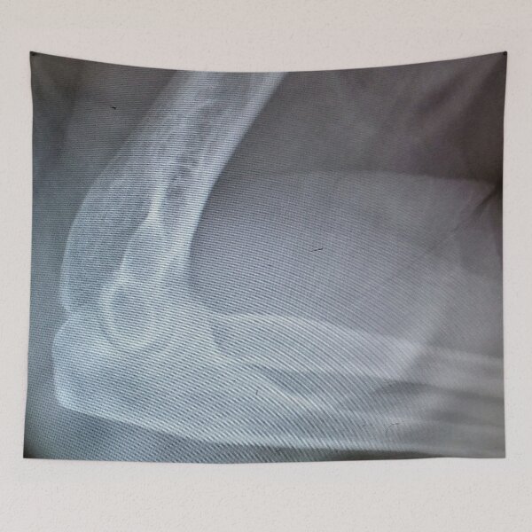 Item preview, X-Rayed Elbow designed and sold by Scott and Mary Schneider art_photography.