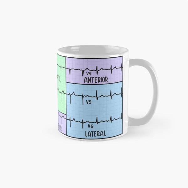 Item preview, Hand Drawn 12 Lead Electrocardiogram (ECG) Pastel designed and sold by SofiaSava01.