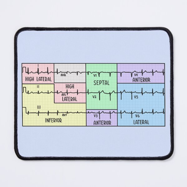 Aperçu de l'œuvre Pastel d'électrocardiogramme (ECG) à 12 dérivations dessiné à la main créée et vendue par SofiaSava01.