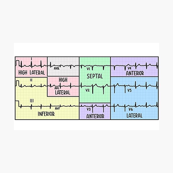 Item preview, Hand Drawn 12 Lead Electrocardiogram (ECG) Pastel designed and sold by SofiaSava01.