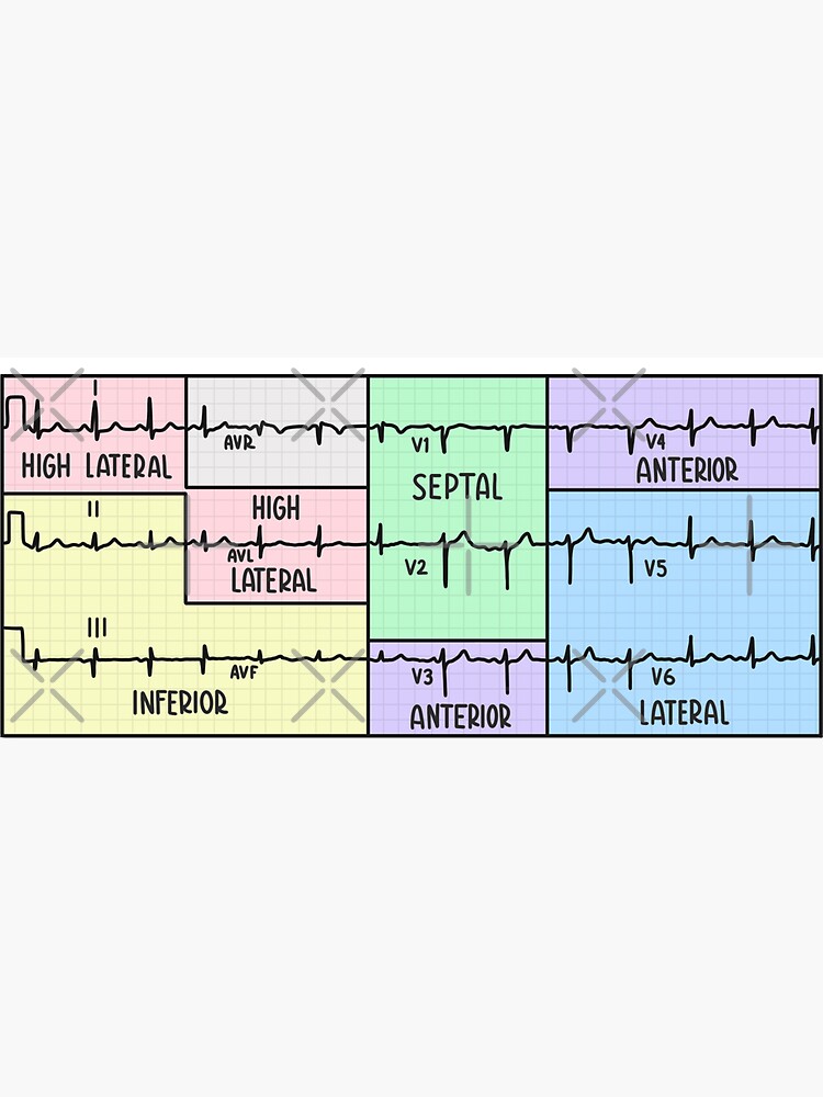 Thumbnail 3 of 3, Magnet, Hand Drawn 12 Lead Electrocardiogram (ECG) Pastel designed and sold by SofiaSava01.