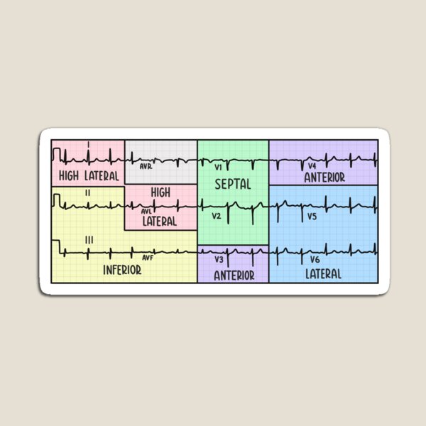 Item preview, Hand Drawn 12 Lead Electrocardiogram (ECG) Pastel designed and sold by SofiaSava01.