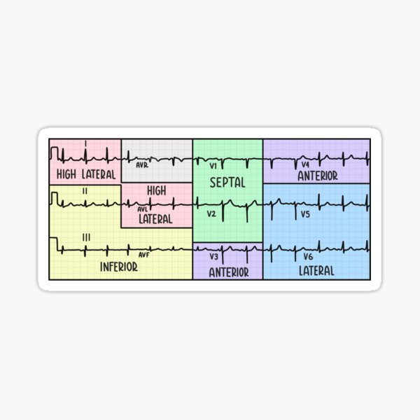 Pastel d'électrocardiogramme (ECG) à 12 dérivations dessiné à la main Sticker