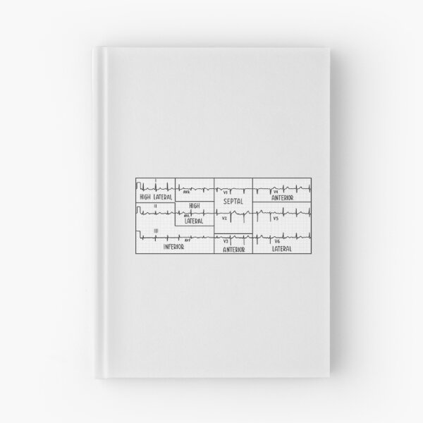 Item preview, Hand Drawn Electrocardiogram (ECG) Black designed and sold by SofiaSava01.