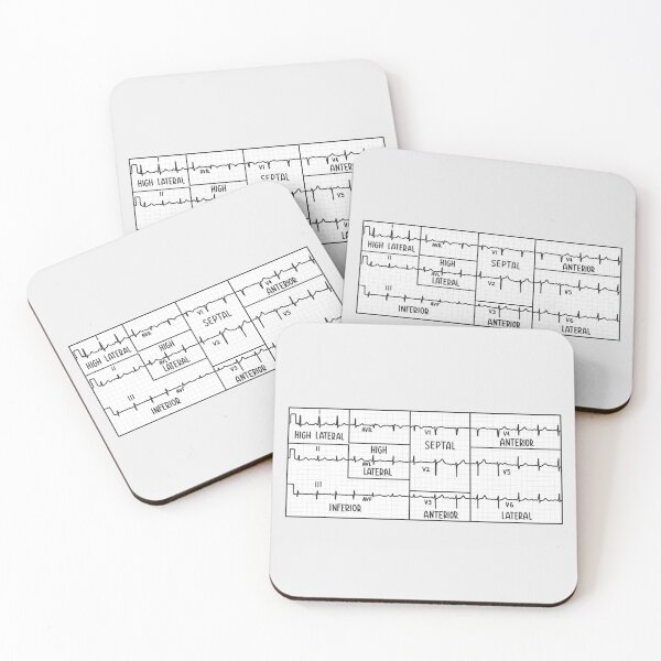 Item preview, Hand Drawn Electrocardiogram (ECG) Black designed and sold by SofiaSava01.