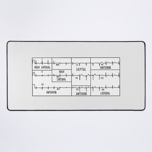 Item preview, Hand Drawn Electrocardiogram (ECG) Black designed and sold by SofiaSava01.