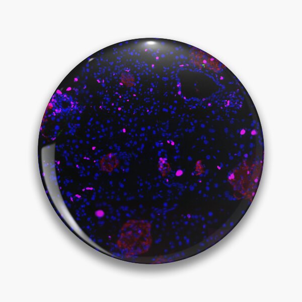 Item preview, Pancreatic Islet IF Image Collage designed and sold by neatchicdesigns.