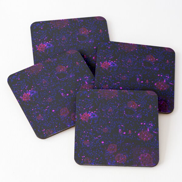 Item preview, Pancreatic Islet IF Image Collage designed and sold by neatchicdesigns.
