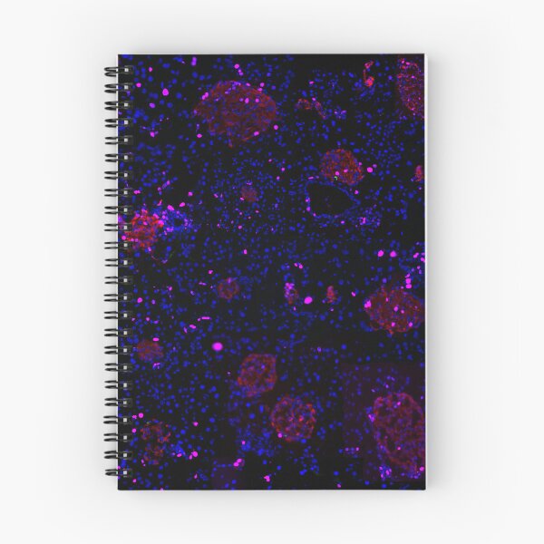 Item preview, Pancreatic Islet IF Image Collage designed and sold by neatchicdesigns.