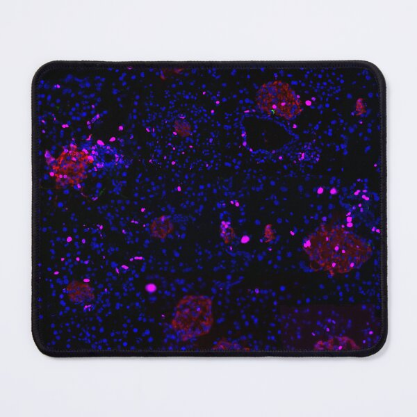 Item preview, Pancreatic Islet IF Image Collage designed and sold by neatchicdesigns.