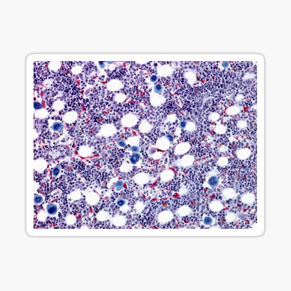 Item preview, Bone marrow, light micrograph (F002/9968) designed and sold by SciencePhoto.