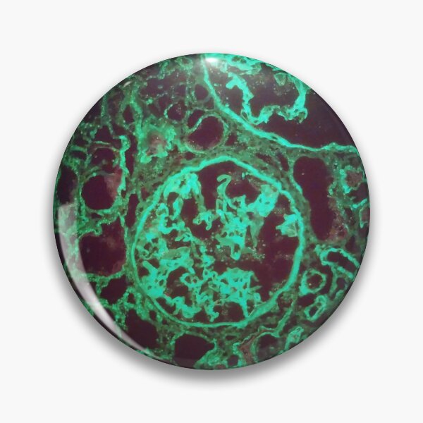 Item preview, Immunofluorescent glomeruli, kidney histology designed and sold by Psymier.