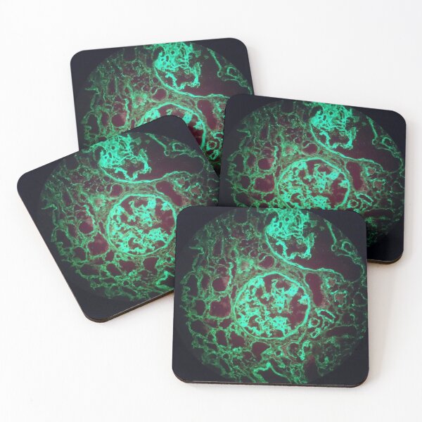 Item preview, Immunofluorescent glomeruli, kidney histology designed and sold by Psymier.
