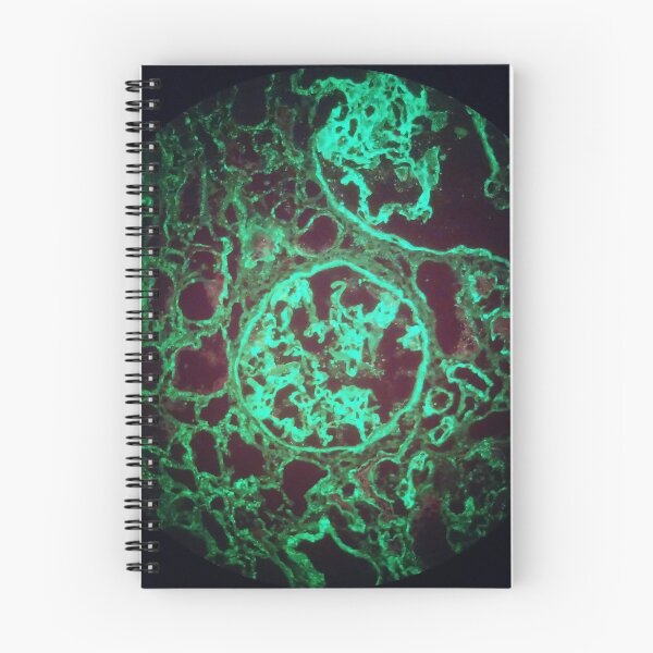 Item preview, Immunofluorescent glomeruli, kidney histology designed and sold by Psymier.