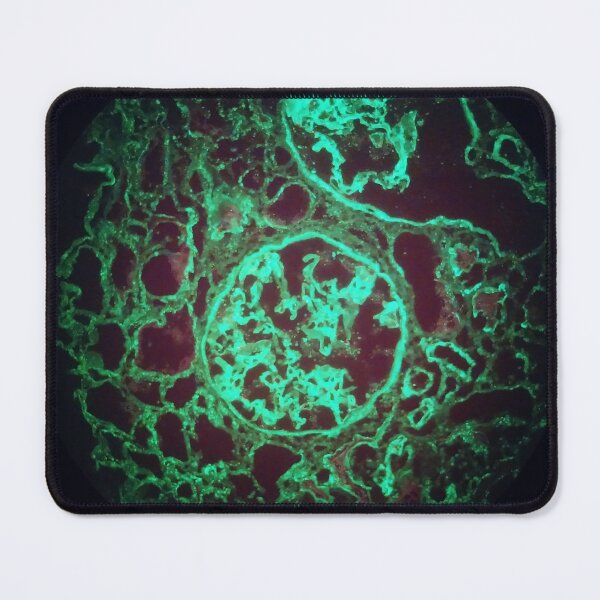 Item preview, Immunofluorescent glomeruli, kidney histology designed and sold by Psymier.
