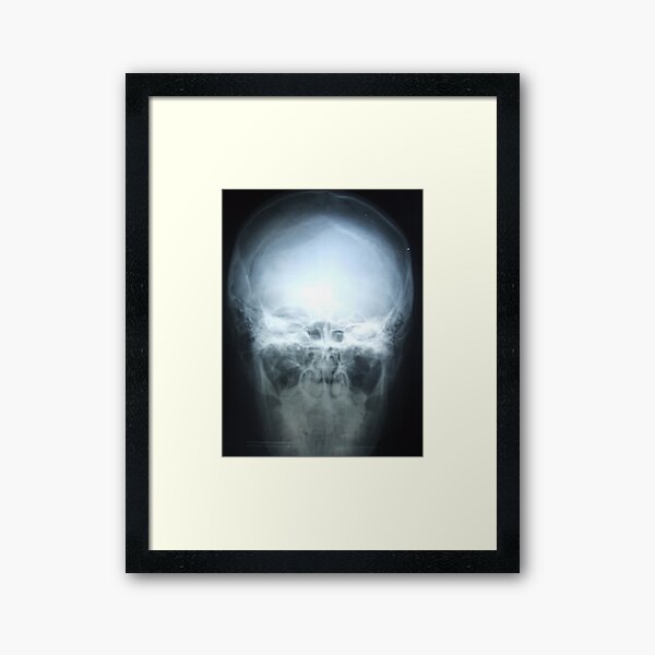 I Framed Art Print