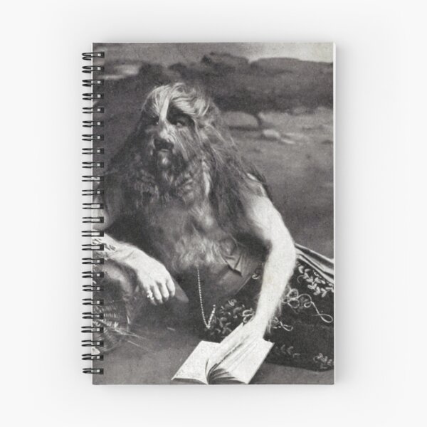 Item preview, Stephan Bibrowski, Known as the Lion Faced Man, Circus Performer. 1918 designed and sold by ScienceSource.