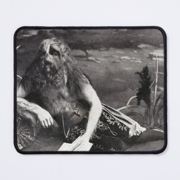Item preview, Stephan Bibrowski, Known as the Lion Faced Man, Circus Performer. 1918 designed and sold by ScienceSource.