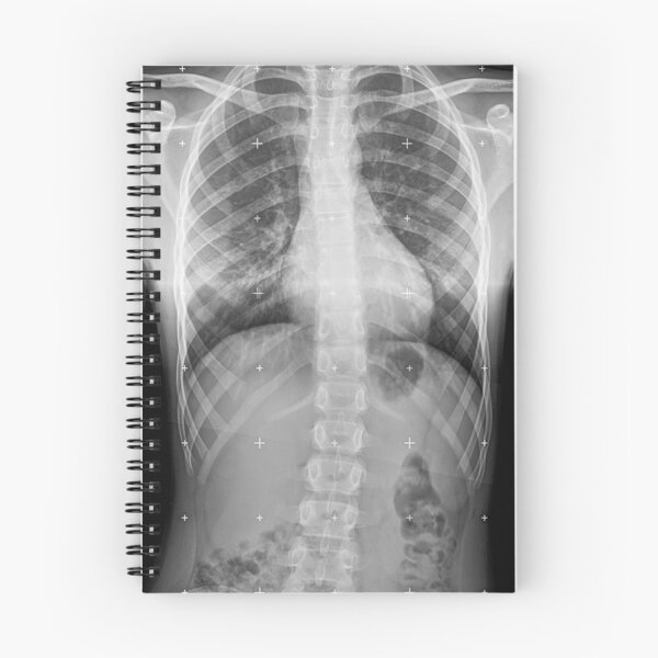 Item preview, X-ray designed and sold by JoaoGaspar.