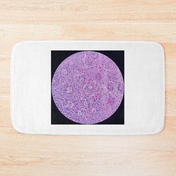 Item preview, Skin histology, tangential, dysplastic, 200x H&E designed and sold by Psymier.