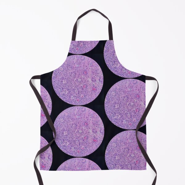 Item preview, Skin histology, tangential, dysplastic, 200x H&E designed and sold by Psymier.