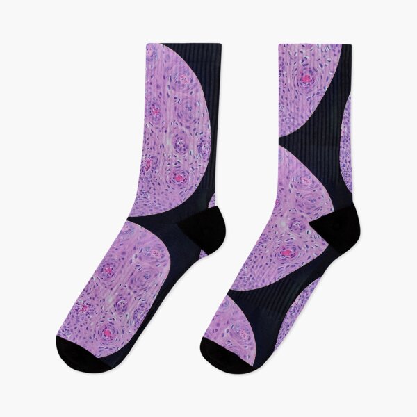 Item preview, Skin histology, tangential, dysplastic, 200x H&E designed and sold by Psymier.