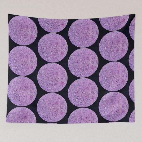 Item preview, Skin histology, tangential, dysplastic, 200x H&E designed and sold by Psymier.