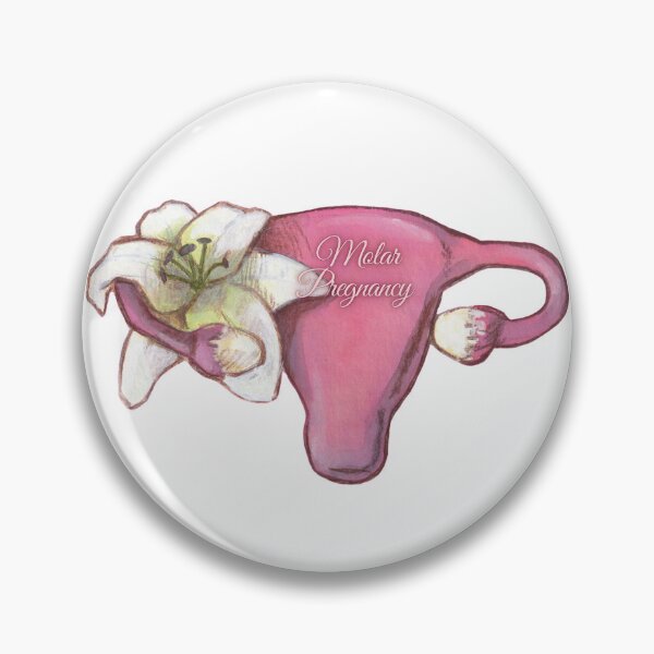 Item preview, Pregnancy Loss - Molar Pregnancy designed and sold by Pauline French.