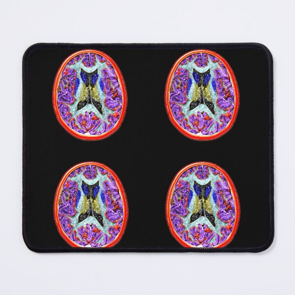 Item preview, Cross-Sectional MRI of the Human Brain, medical Scan designed and sold by ScienceSource.