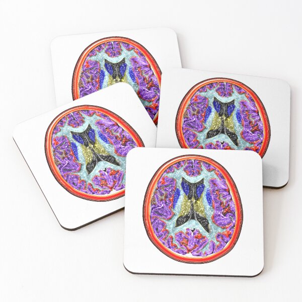 Item preview, Cross-Sectional MRI of the Human Brain, medical Scan designed and sold by ScienceSource.