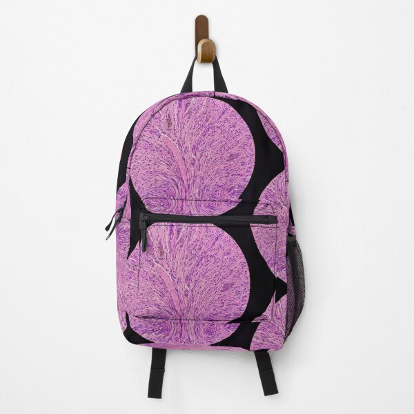 Item preview, Histology of stomach, iron pill gastritis, H&E, 40x designed and sold by Psymier.