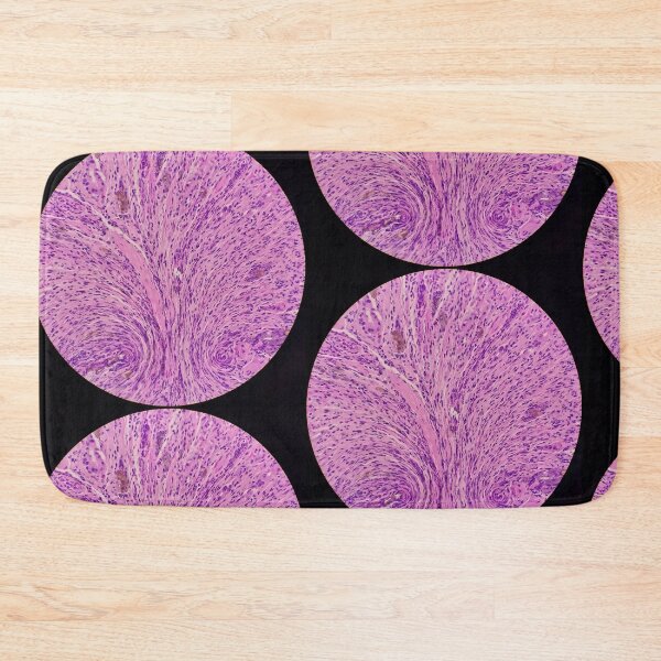 Item preview, Histology of stomach, iron pill gastritis, H&E, 40x designed and sold by Psymier.