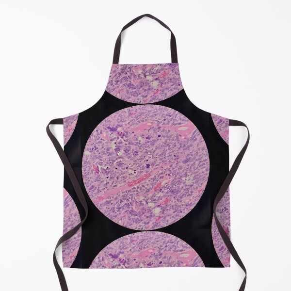 Item preview, Histology of malignant tumour, cancer, bizarre mitosis, H&E, 400x designed and sold by Psymier.