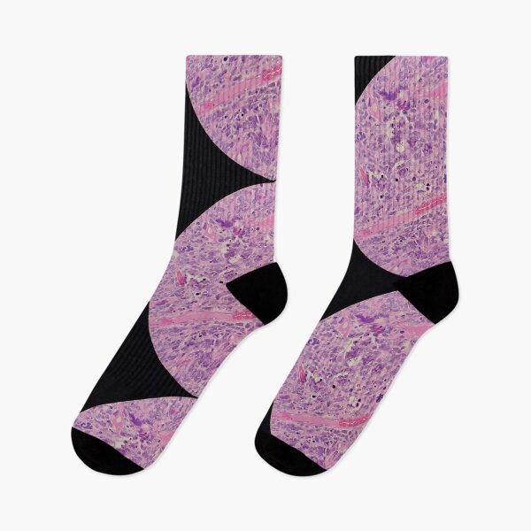 Item preview, Histology of malignant tumour, cancer, bizarre mitosis, H&E, 400x designed and sold by Psymier.