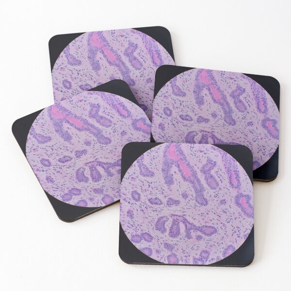 Item preview, Histology of glands, human tissue, H&E, 100x designed and sold by Psymier.