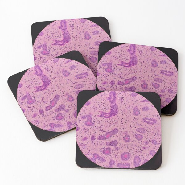 Item preview, Histology of secreting glands, human tissue, H&E, 100x designed and sold by Psymier.