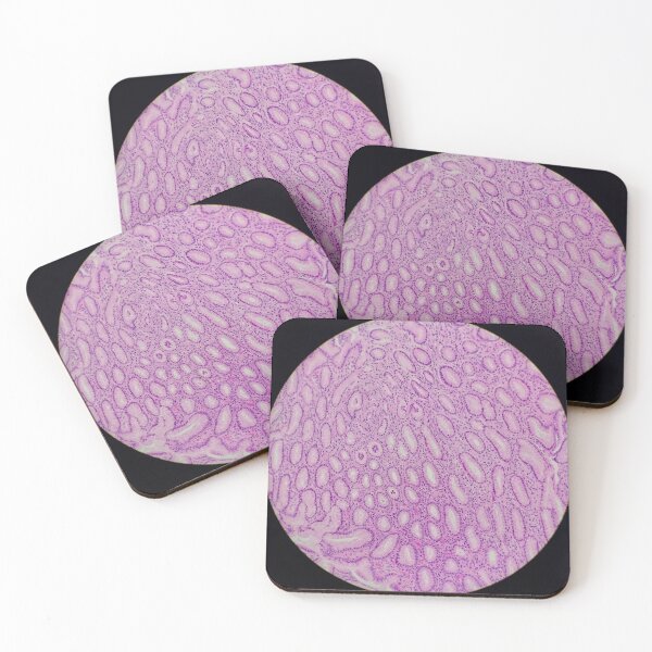 Item preview, Histology of stomach glands, human tissue, H&E, 20x designed and sold by Psymier.