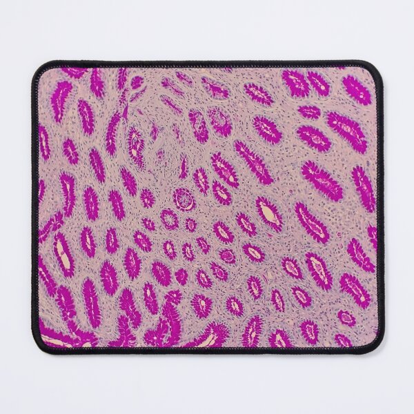 Item preview, Histology of stomach glands, human tissue, AB/PAS, 20x designed and sold by Psymier.