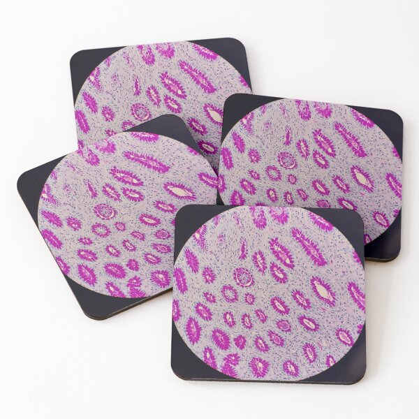 Item preview, Histology of stomach glands, human tissue, AB/PAS, 100x designed and sold by Psymier.