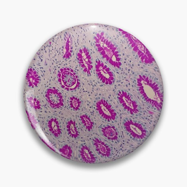 Item preview, Histology of stomach glands, human tissue, AB/PAS, 100x designed and sold by Psymier.