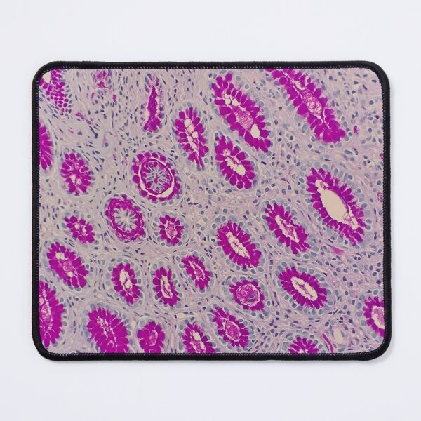 Item preview, Histology of stomach glands, human tissue, AB/PAS, 100x designed and sold by Psymier.