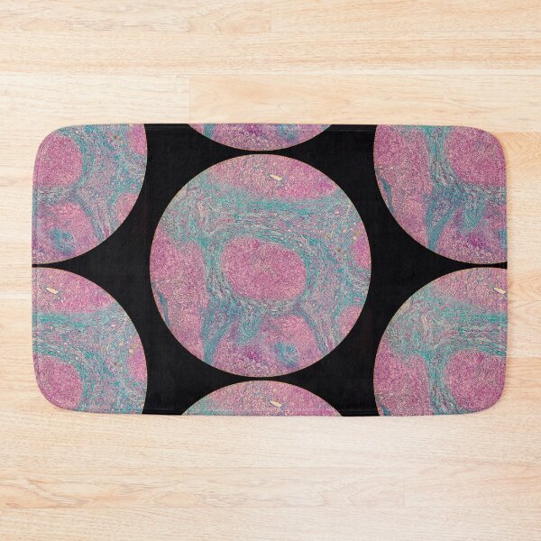 Item preview, Histology of liver cirrhosis, nodule, human tissue, Masson's trichrome, 40x designed and sold by Psymier.